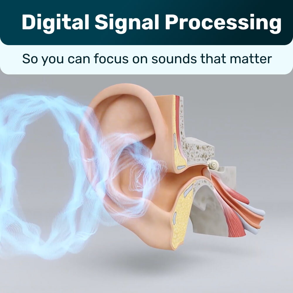OmniHear image